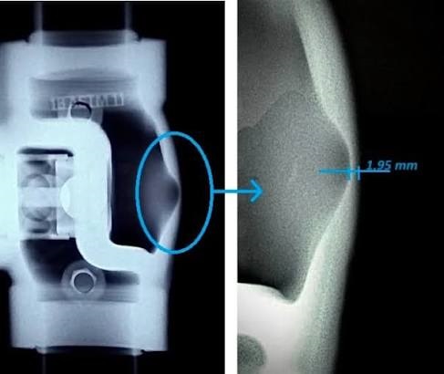 radiographic inspection
